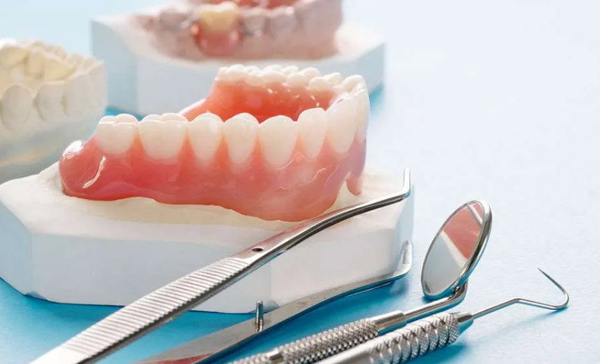 Complete Dentures by Smile Experts in St. Albert