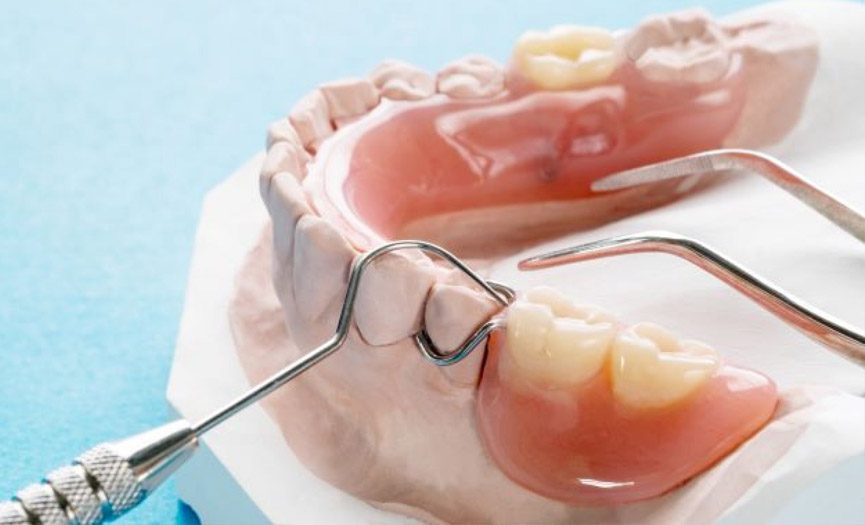 Partial Dentures by Smile Experts in St. Albert 2